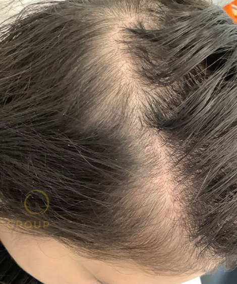 After using See visible results with regular use