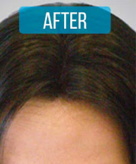 After using See visible results with regular use