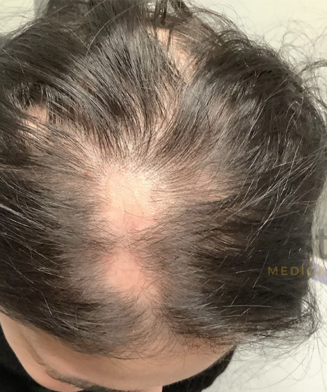 Before using See visible results with regular use