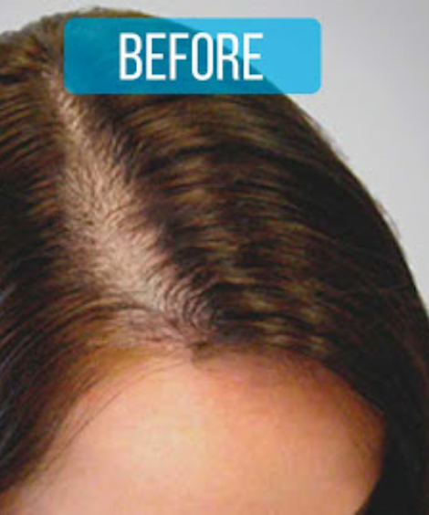 Before using See visible results with regular use